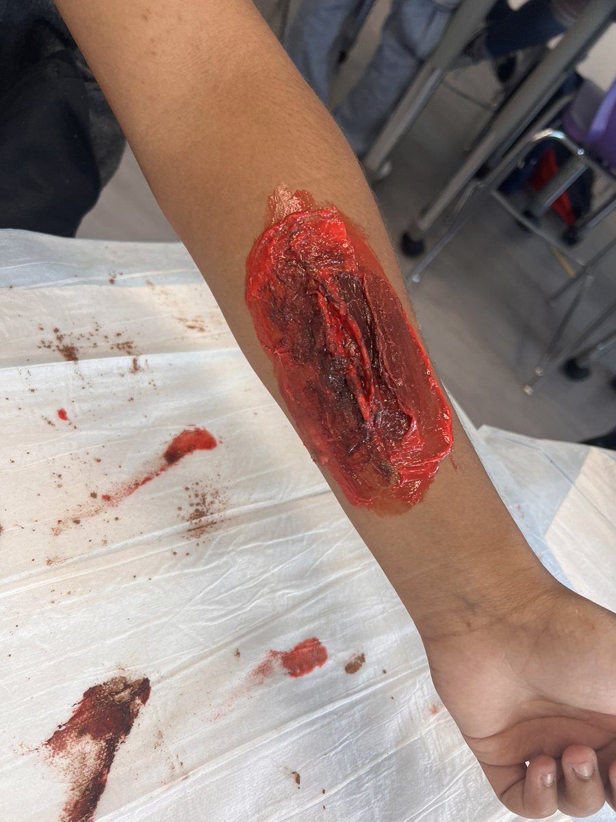 Mrs. Buswell’s class created realistic wounds to wrap up the integumentary system. #Halloween#Fakewounds#CTE