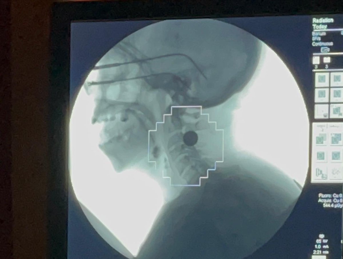 gregmd_cincy's tweet photo. Trying out a new C-ARM today for our Fluoroscopy clinic and research trials 🔬 @dysphagia_rehab_lab #voiceandswallowing #cincinnati #ent #dionlab #patientsfirst @UCincyMedicine @UC_CoMResearch https://t.co/HOsOPZLZ51