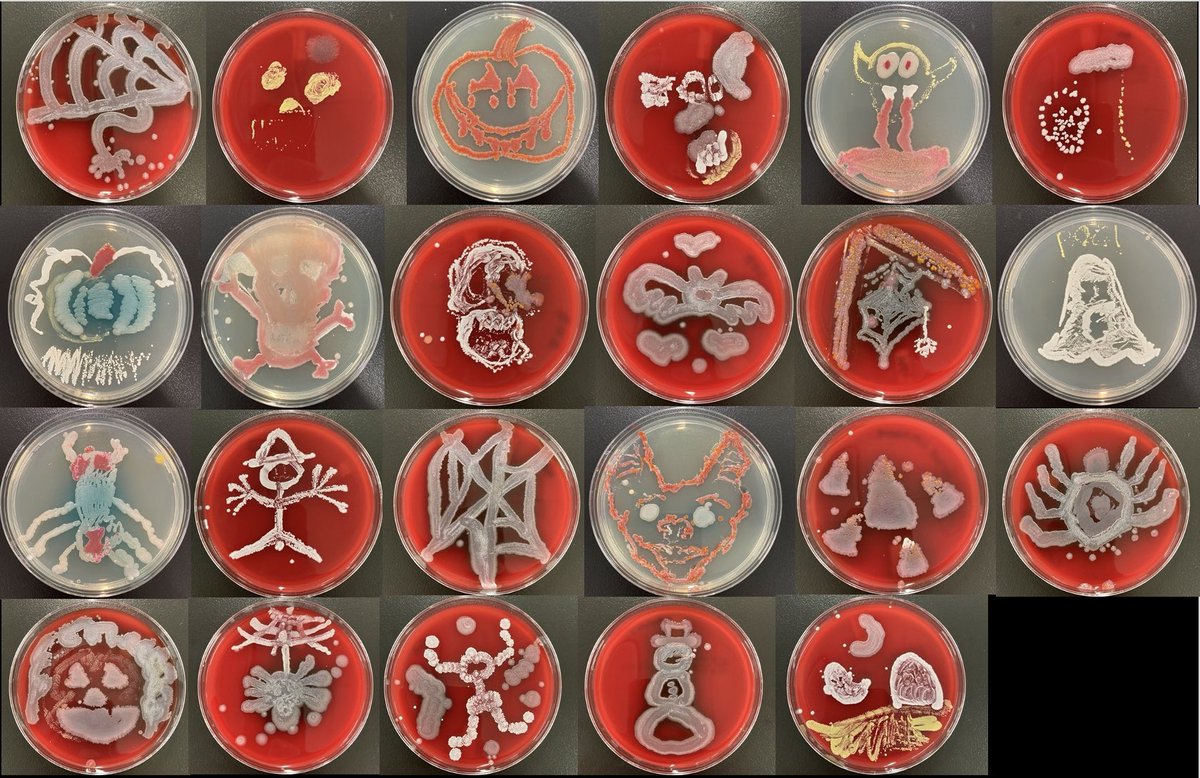 ButlerUlas's tweet image. Dr. Stobart’s BI 438 Microbiology course produced some Halloween themed petri dish art using four different colored bacterial strains. Spooky! @butleru