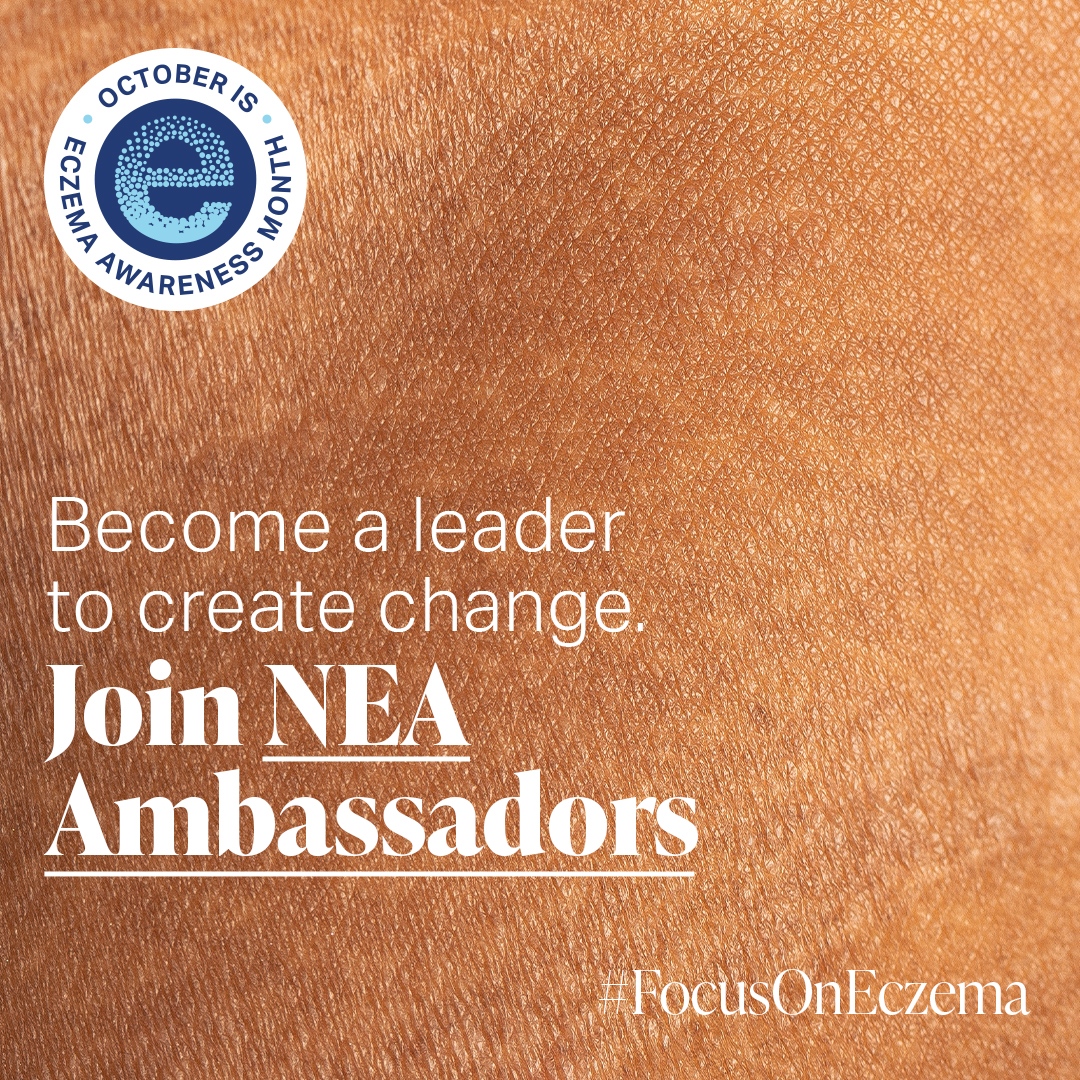 nationaleczema's tweet photo. Celebrate the last day of #EczemaAwarenessMonth 2022 by becoming a #NEAAmbassador and creating meaningful change in the #eczema community.
Learn more and join the team: https://t.co/6gxlO5oflQ
#EczemaAwarenessMonth #EAM22 #FocusonEczema #NEAAmbassador #createchange https://t.co/F67lbWXFV1