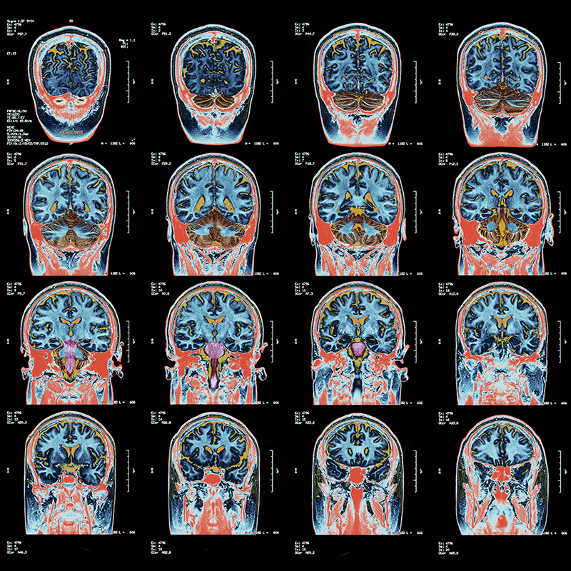HMethodistMD's tweet photo. Houston Methodist, Rice University and Baylor College of Medicine to develop sleeping cap that helps the brain clear metabolic waste and improve sleep in real time. Long-term it could delay neurodegenerative disease.  #sleepdisorders #neuroregenerativedisease