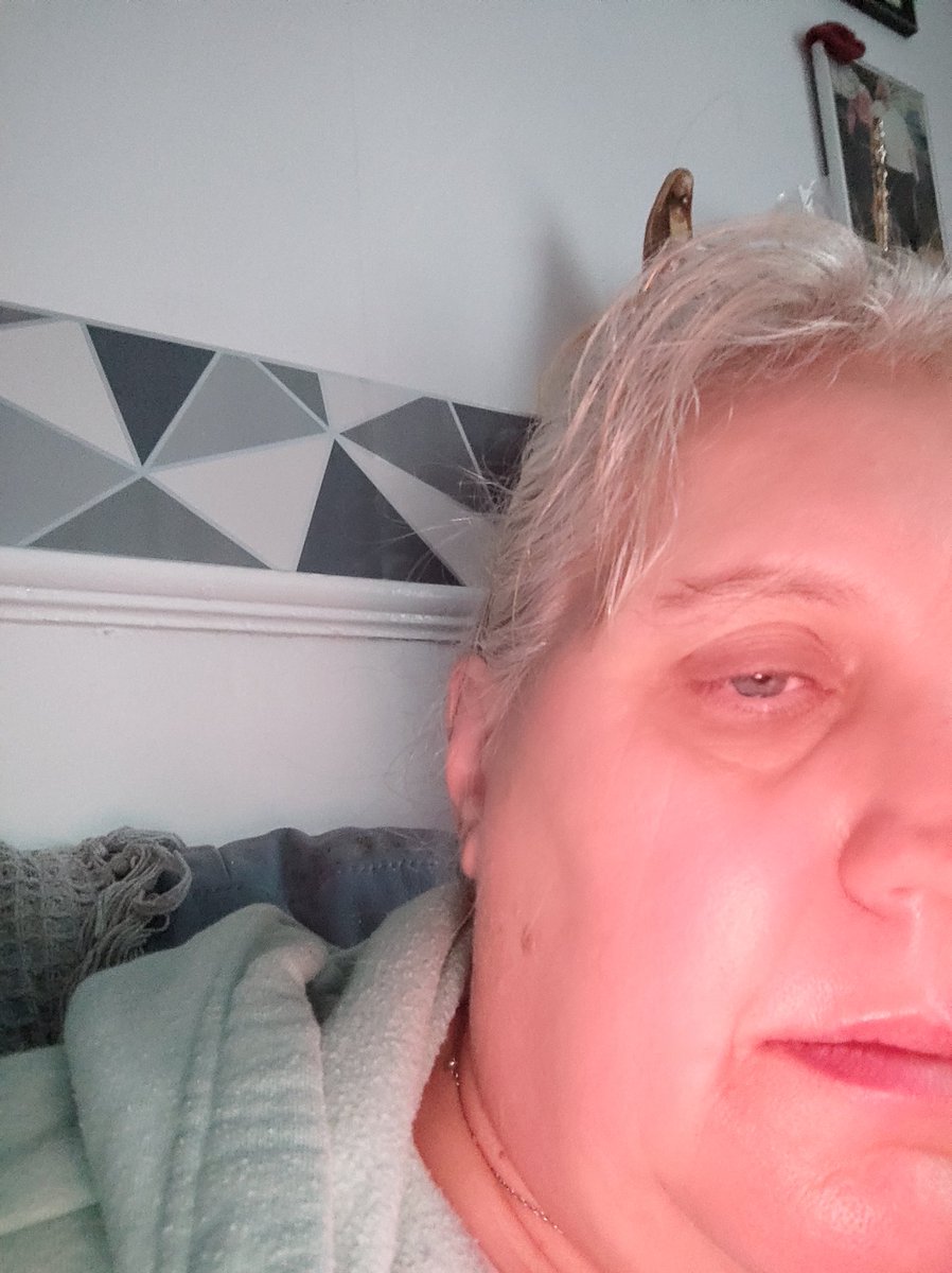 kim_wears's tweet photo. I'm really hoping my swollen face from a nasty tooth extraction today does not bruise. I'm hopeful a decent night's sleep should make me feel better xxx #toothout #extraction https://t.co/ebHJWVBYd8
