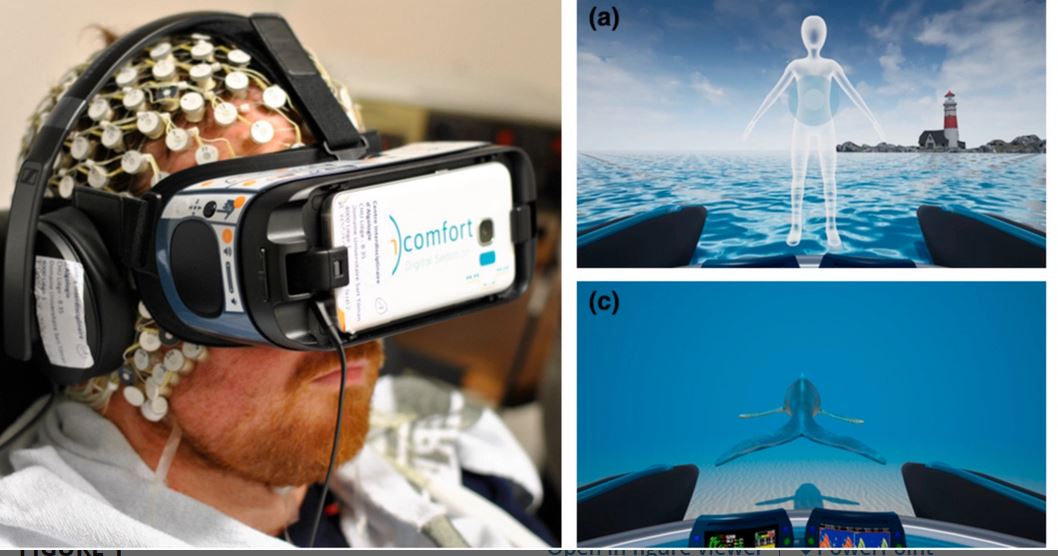 Magstim EGI (@magstimegi) on Twitter photo New Study: Virtual reality #hypnosis in the management of pain: Selfāreported and neurophysiological measures in healthy subjects. Study used Magstim EGI 256 electrode GSN net. #eeg #neuroscience <a href="/AcademicEEG/">AcademicEEG</a> onlinelibrary.wiley.com/doi/10.1002/ej⦠New Study: Virtual reality #hypnosis in the management of pain: Selfāreported and neurophysiological measures in healthy subjects. Study used Magstim EGI 256 electrode GSN net. #eeg #neuroscience <a href="/AcademicEEG/">AcademicEEG</a> onlinelibrary.wiley.com/doi/10.1002/ejā¦