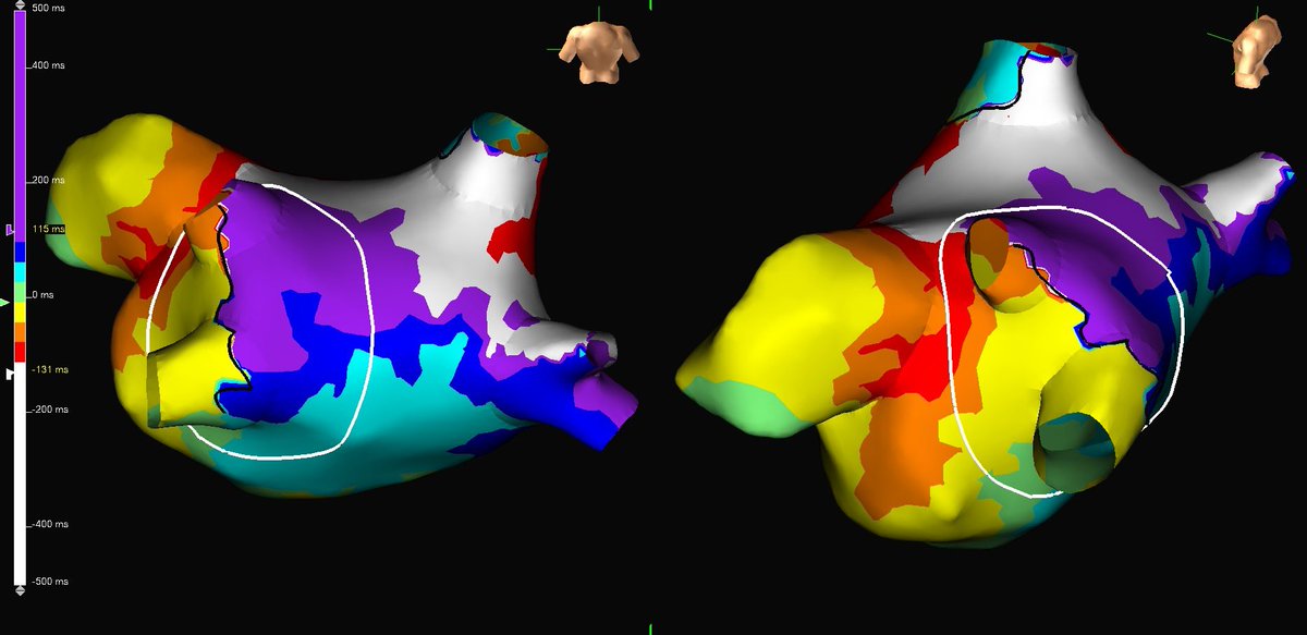 Betty Bu tweet media