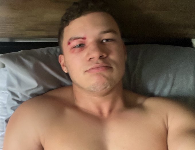 👹👹👹 https://t.co/Q4omWWc4L5