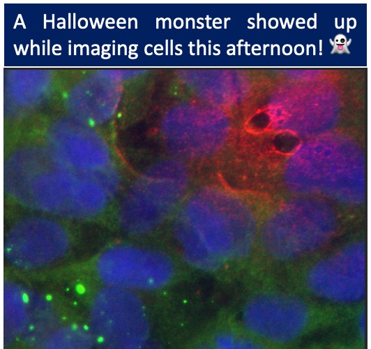 A microscopy monster to celebrate Halloween! 🎃 👻