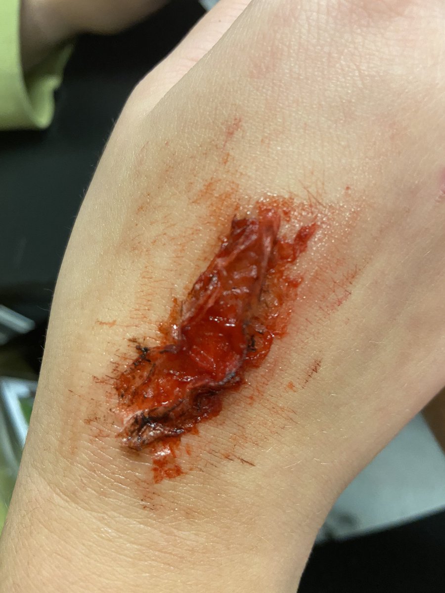 Knightlife_MHS's tweet photo. Spooky 💀Wound Lab! @MISDCareerTech @MrHollander_MHS @MHS_Starkey_AP @tennison_toni #mhscte #skin #zombielife https://t.co/Kj27cX09k3