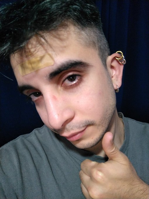 Me explote un grano y no me paro de sangrar xD https://t.co/qUedgs7VFG