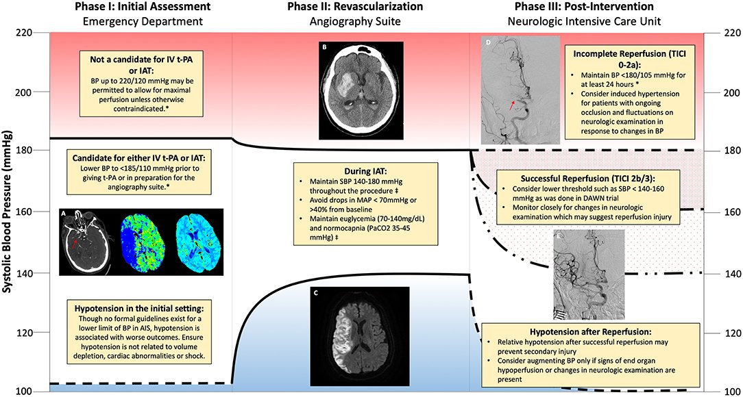 StrokeCliTrials's tweet photo. IV thrombolysis, Endovascular therapy and BP management.

https://t.co/eKjWNiNwlQ https://t.co/f2nUgTtYj5