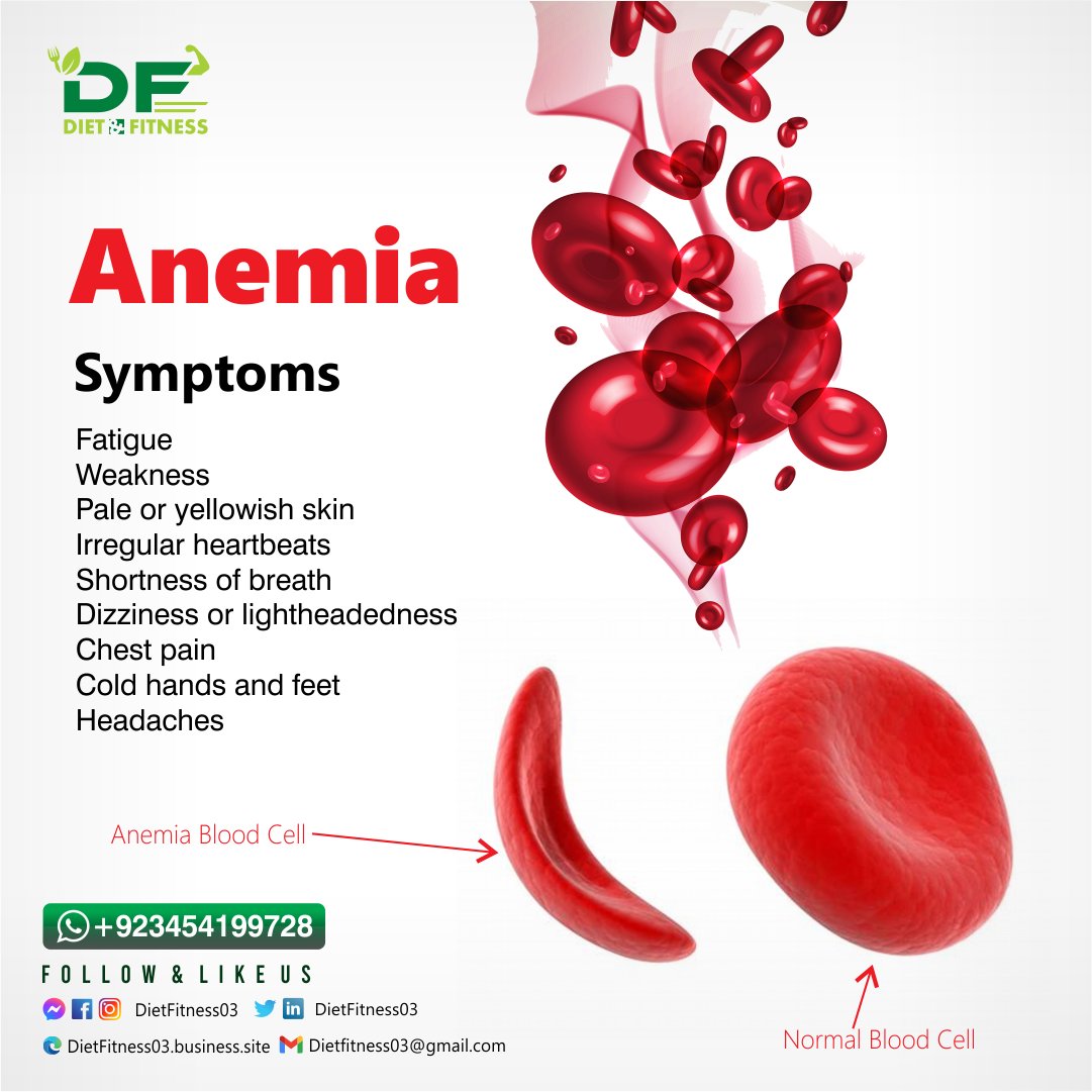 dietfitness03's tweet photo. Anemia
#anemia #diabetes #iron #irondeficiency #health #cancer #insomnia #anemiaproblems #covid #darahtinggi #jusdrinks #stroke #herbal #healthylifestyle #hipertensi #sembelit #kolesterol #detox #spirulina #blood #chronicpain #blunkdos #jantung #chronicillness #kolestrol #sehat https://t.co/Rs5AXC3WYK