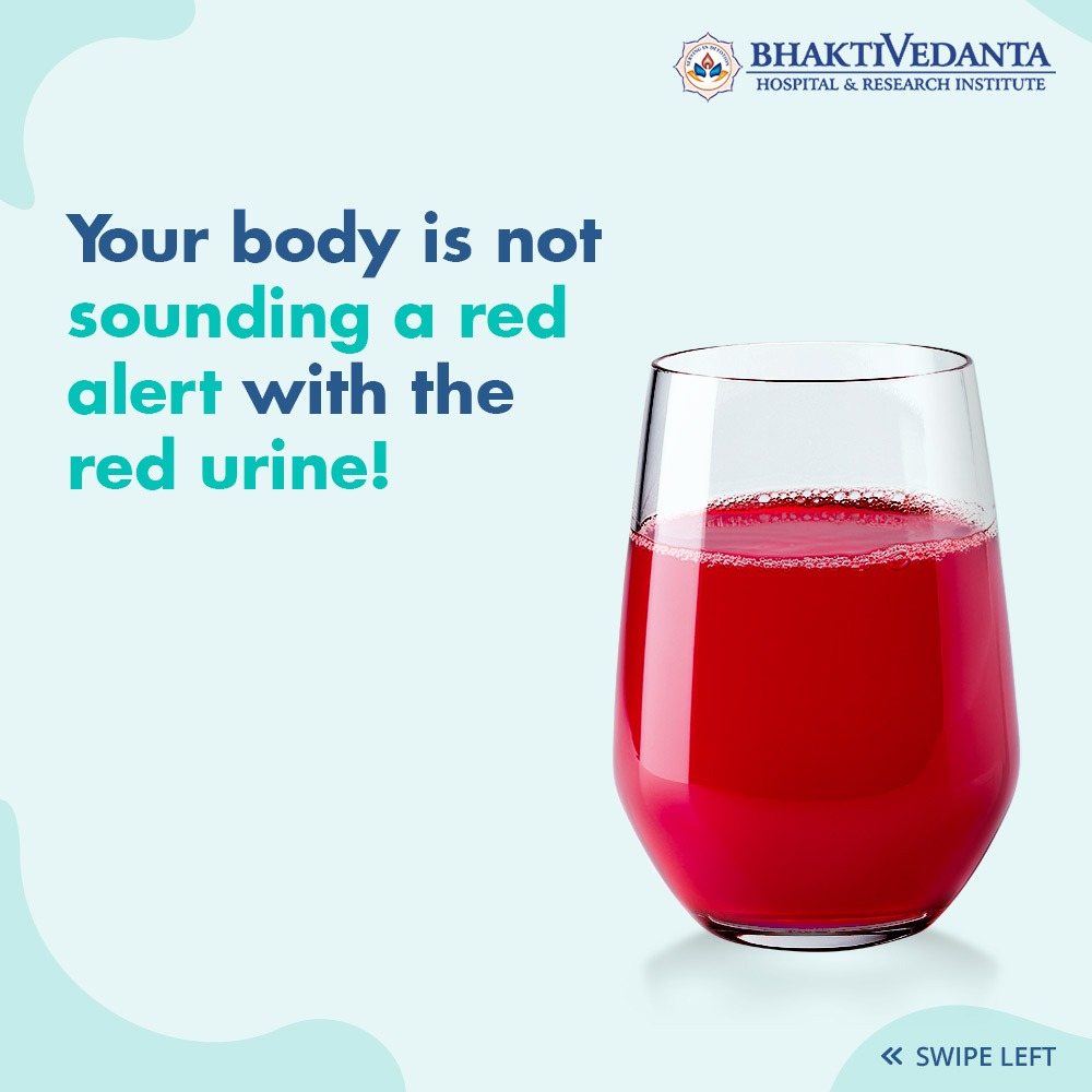 Bhaktivedanta_H's tweet photo. If you notice a red or pink tint in your urine, then there is no need to panic as you had beetroot for lunch.
#beetroot #beeturia #discoloration #urine #medtwitter #bhaktivedantahospital https://t.co/PKA33osyq2