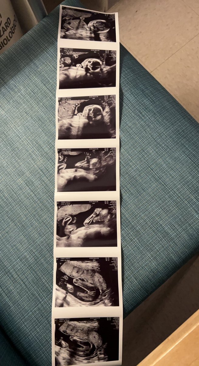 Babychoc is gonna be a little girl!! AHHHHH!! Lord help me