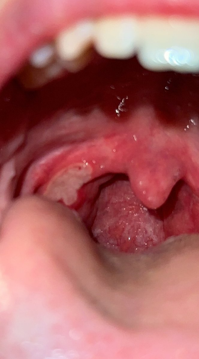 Inoxtag ⚡️ tweet media