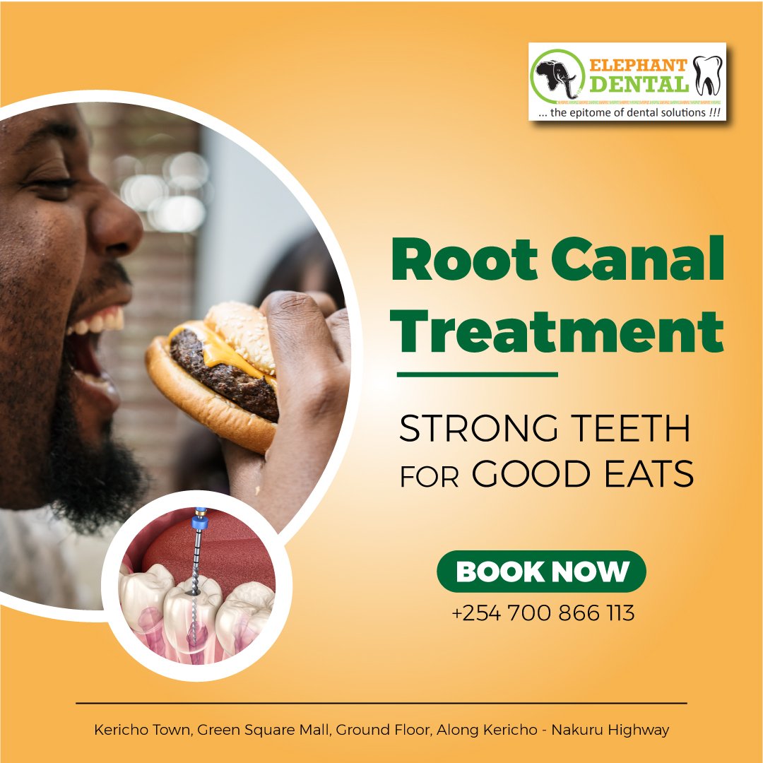 ElephantKericho's tweet photo. Root Canal is relatively painless and extremely effective. You'll be back to smiling, biting and chewing with ease in no time.
Book your appointment Today!
#waluke #aishajumwa #Migunamiguna #Raila #kamiti https://t.co/7as5Br31kH