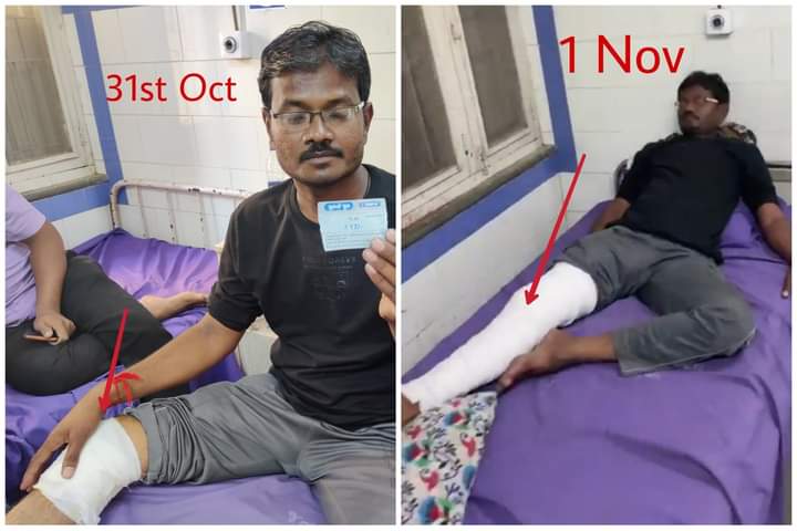 Rajeshumaretiy3's tweet photo. મોદીજીને મોરબી હોસ્પિટલનો વિકાસ દેખાડવા માટે નાના પાટા માંથી પ્લાસ્ટરનો પાટો બાંધવામાં આવ્યો..
આઘા રેજો હો હવે વિકાસ ધોદે ચડયો છે 🤣 https://t.co/JHUv72Rt3V