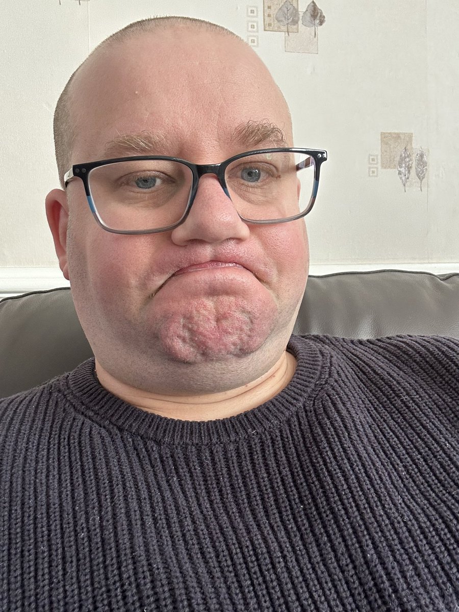 PacFish's tweet image. Raising funds with my face! Any donations appreciated. uk.movember.com/mospace/755757…