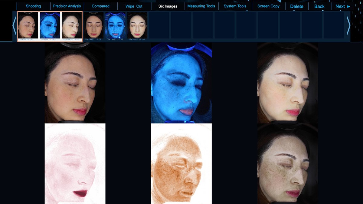 QuipDerma's tweet photo. DermaQuip offers the latest up and coming technology including the PEAR 3D Skin Analysis system. The PEAR 3D offers the best before and after pictures on the market. 

Visit Now - https://t.co/Tr7hGKb4Mr https://t.co/opFQu7G1tO