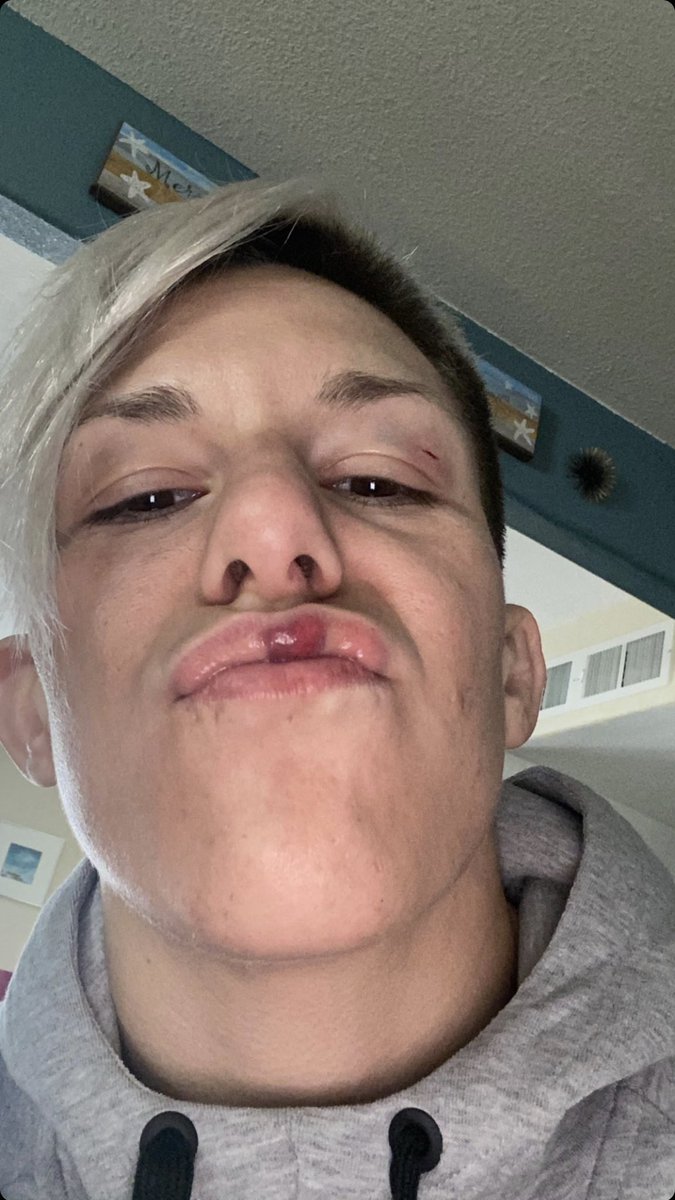 Battle scarred… money made.