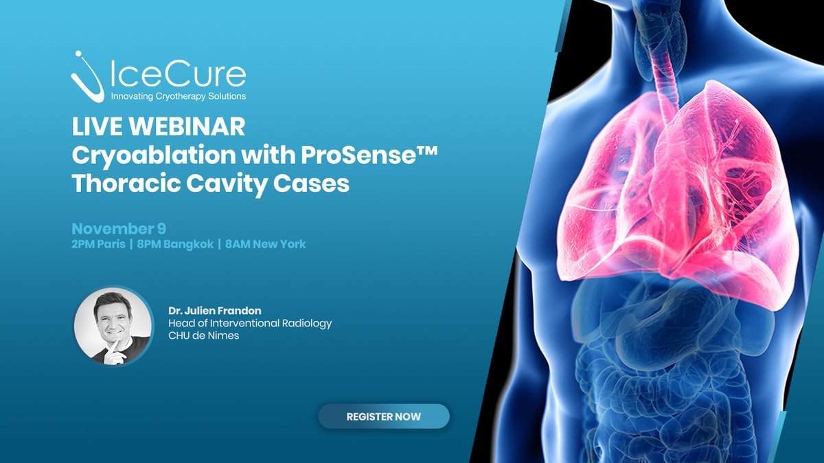 IceCure Medical (@icecuremedical) on Twitter photo Join <a href="/IceCureMedical/">IceCure Medical</a>'s #webinar November 9 at 2PM CET to learn more about performing #cryoablation with #ProSense in the thoracic cavity with Dr. <a href="/FrandonJulien/">frandon julien</a>, Head of #InterventionalRadiology at <a href="/CHUNimes/">CHU de Nîmes</a>.
Register today! --> us02web.zoom.us/webinar/regist…
#interventionaloncology Join <a href="/IceCureMedical/">IceCure Medical</a>'s #webinar November 9 at 2PM CET to learn more about performing #cryoablation with #ProSense in the thoracic cavity with Dr. <a href="/FrandonJulien/">frandon julien</a>, Head of #InterventionalRadiology at <a href="/CHUNimes/">CHU de Nîmes</a>.
Register today! --> us02web.zoom.us/webinar/regist…
#interventionaloncology