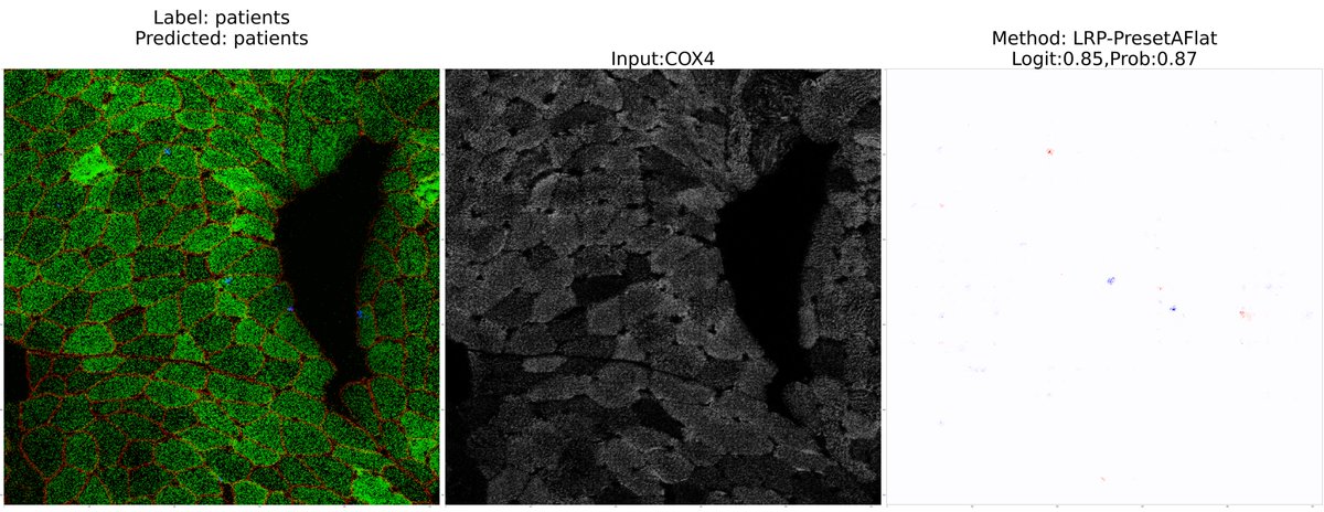 cnrlwlss's tweet photo. In our latest preprint we use Deep Learning to predict the status of subjects (patient with mitochondrial disease or healthy control) from Image Mass Cytometry image stacks captured from human muscle tissue biopsies.  

https://t.co/s9g7iYH2jW https://t.co/T8Gy3wxUZg