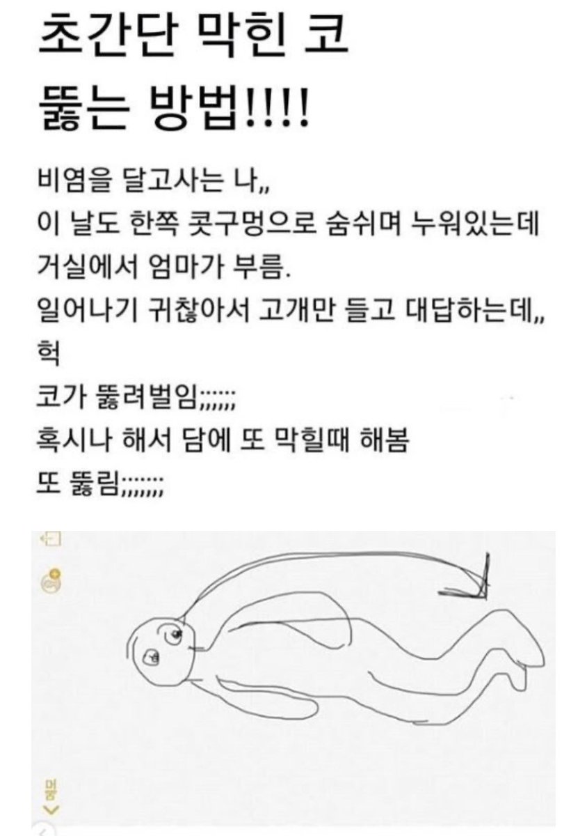 medium_wn's tweet photo. ㅁ친 감기때문에 코가 너무 막혀서 진짜 잠도 못자고 인성파탄됐는데 인터넷뒤지다가 찾은건데 이자세하고 바로 뻥뚫림 ..... 지금 내스스로가 이은결같음 ... 우연인가해서 막힐때마다 하는데 나는 백발백중임 .... 미친 이거 발견한사람 노벨상받아야됨 https://t.co/0lwehKyA8R