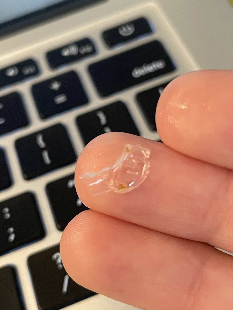 Pretty_Peck16's tweet photo. This is the second time in the last 2wks that I ate a @bagels_thomas and it had plastic baked into it. 🤮. This was from a brand new bag. #lostacustomer https://t.co/HdrJsXwUyk