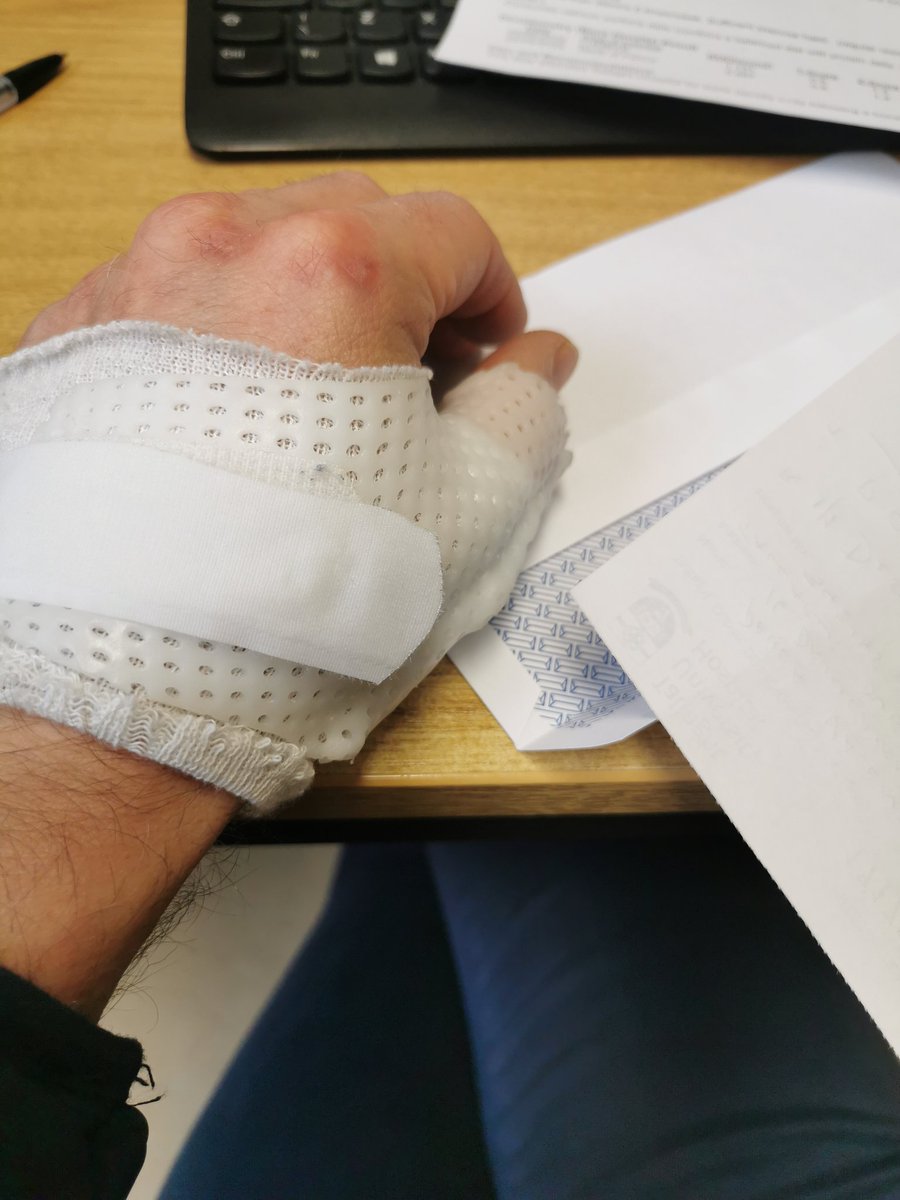 BIGGEST cCNP challenge; envelopes &amp; a buckled thumb 🙄. #gamekeepersthumb