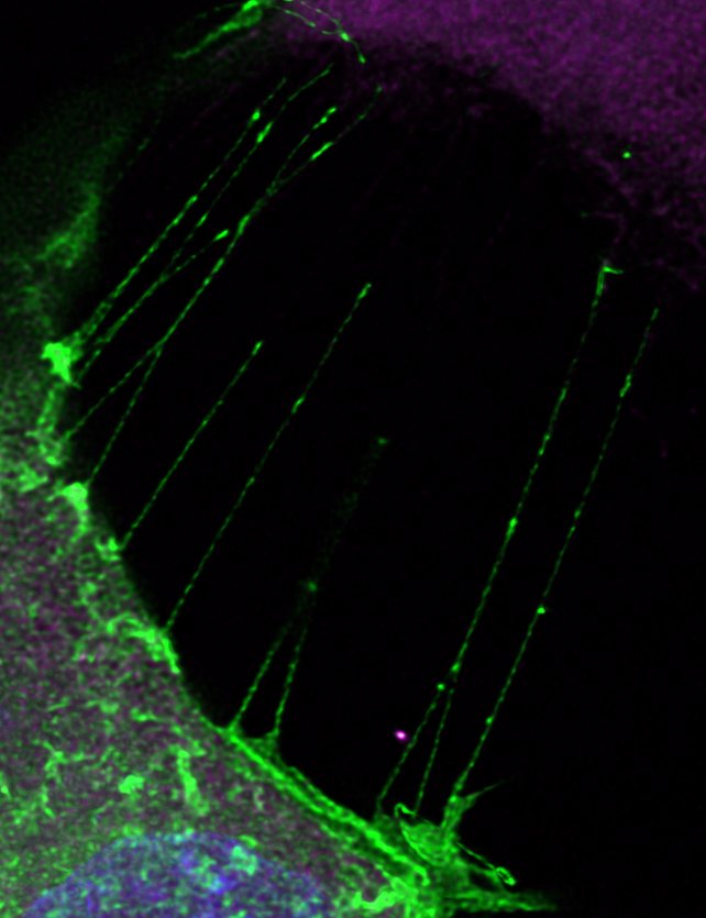 TinaAdele13's tweet photo. Calling all Postdoc applicants! Come work for the @StJudeResearch mentor of the year @lab_ogden and study cellular communication during embryonic development. Projects available to study cytonemes (pictured) or other aspects of cellular signaling 👩‍🔬🔬
https://t.co/dOSgGAeV0u https://t.co/tvJ4mYrSBa