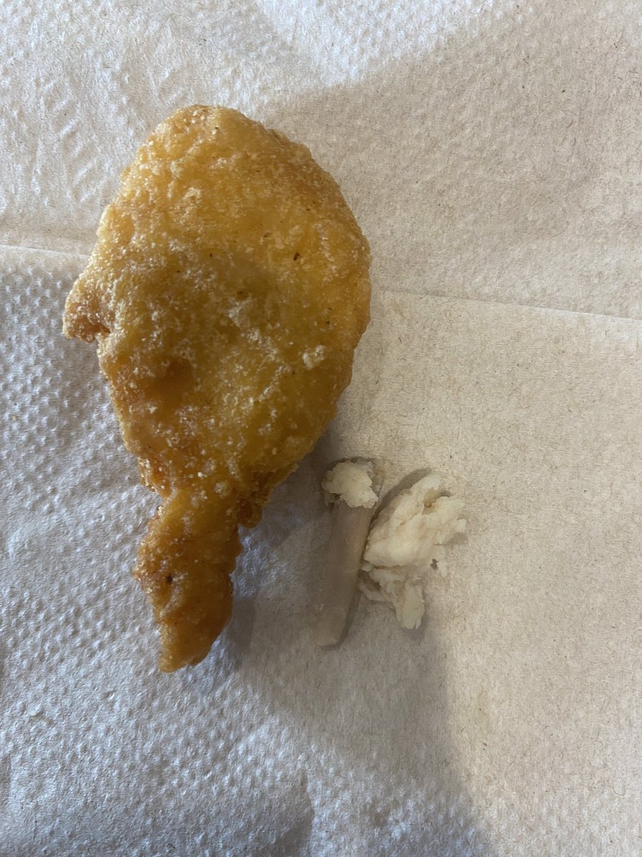 PB (@plumpieb) on Twitter photo I almost choked to death because of this long lengthy bone inside my McDonald’s chicken nugget. WTF! #McDonalds #chicken #confirmed #Trending #reddit #Lawyers #advice #TakeOff #MONEY #restaurants I almost choked to death because of this long lengthy bone inside my McDonald’s chicken nugget. WTF! #McDonalds #chicken #confirmed #Trending #reddit #Lawyers #advice #TakeOff #MONEY #restaurants