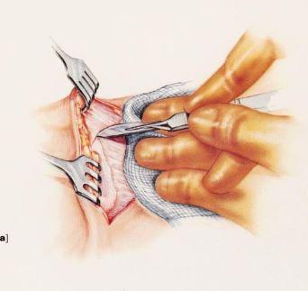 Ron Barbosa MD FACS tweet media