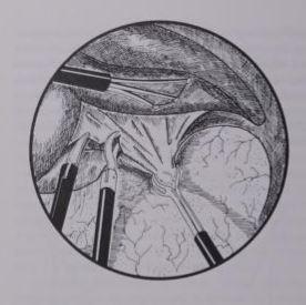 🧵regarding the principles of 'traction' and 'countertraction'.

These are critical skills that you m...