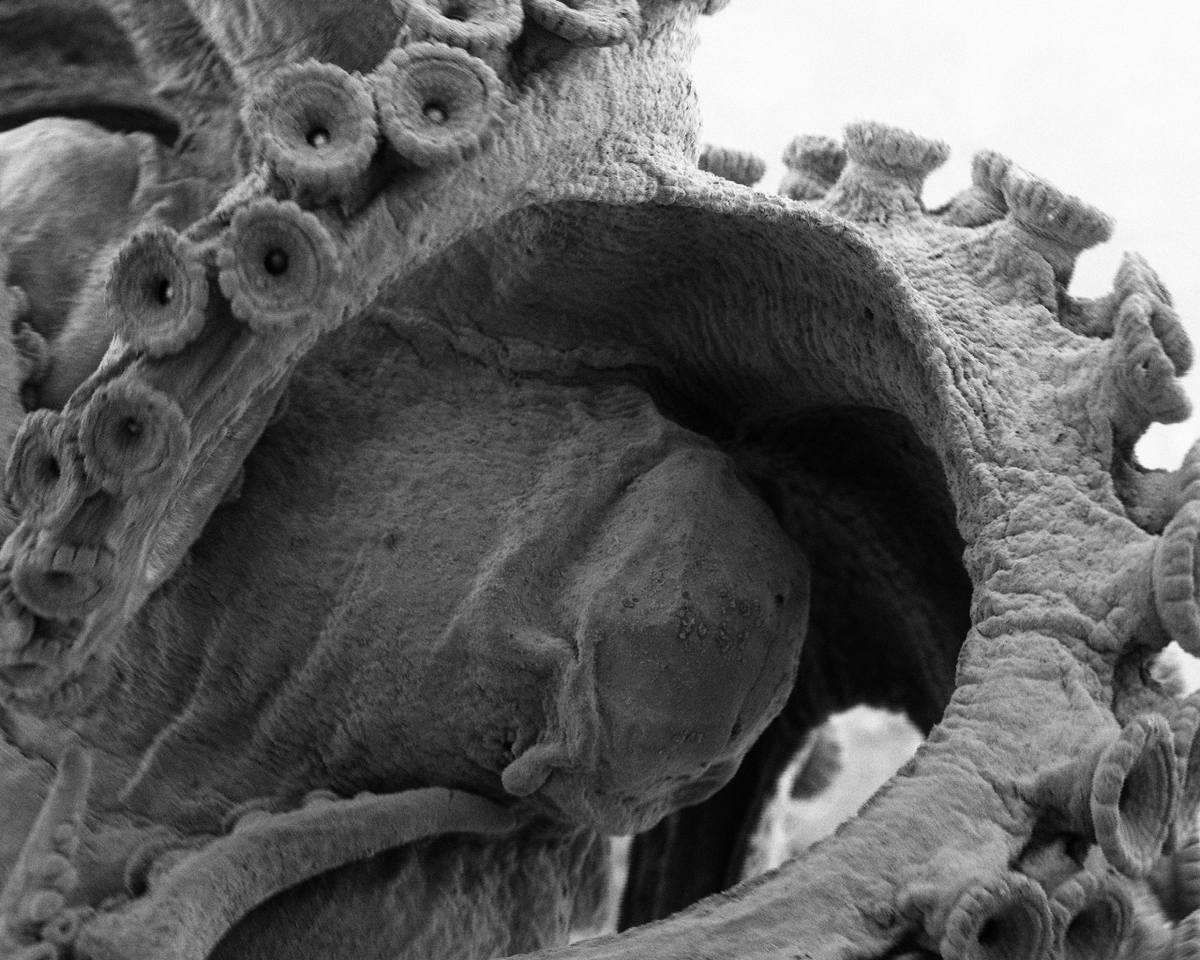 MarineBiol_FHL's tweet photo. We have some stunning Scanning Electron Microscope (SEM) images coming out of our Comparative Anatomy and Physiology course, which is part the AMS program. Check out the intricate detail on this Octopus bimaculoides done by student Molly Philips. @Fishguy_FHL @krillmonger https://t.co/j7zKlaDX9p