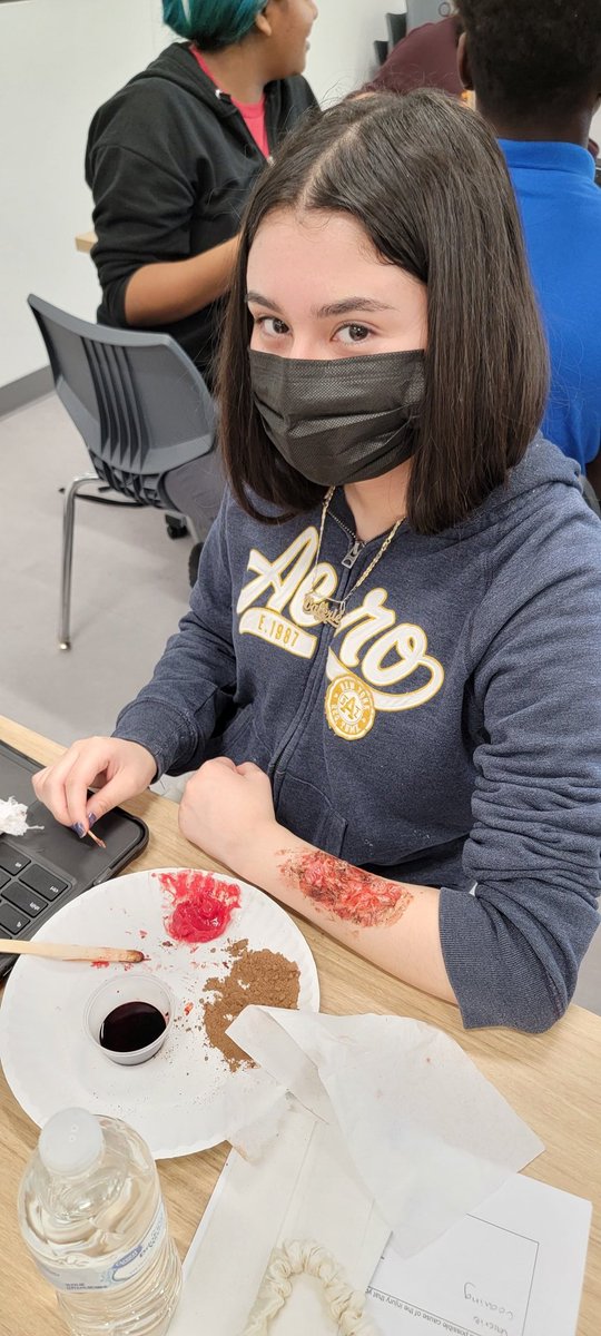MISDVanguardHS's tweet photo. Mrs. Nash's Pathophysiology class participated in a wound lab today learning the different types of wounds that affect different layers of skin. #MISDCTE https://t.co/0oNS5KFi3M