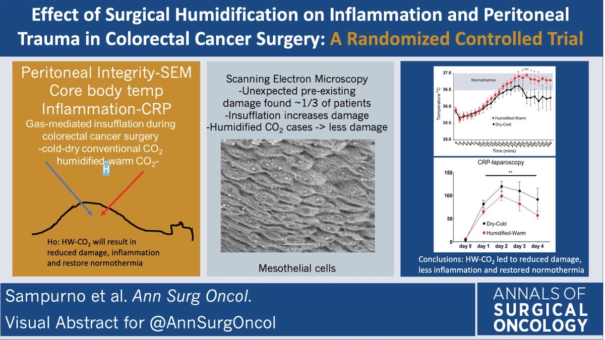Effect of #SurgicalHumidification on Inflammation and #Peritoneal Trauma in #ColorectalCancer Surgery: A Randomized Controlled Trial rdcu.be/cYldh #VisualAbstract <a href="/McMastersKelly/">Kelly McMasters, MD, PhD</a>