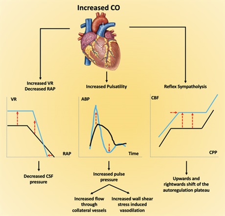 "Cardiac Output &amp; Cerebral Blood Flow: A Systematic Review of Cardio-Cerebral Coupling". An interesting deep dive examining the relationship between CO &amp; CBF and its implications in patients with neurological conditions. <a href="/JNeurosurgAnes/">JNA - Journal of Neurosurgical Anesthesiology</a> #anesthesia 
journals.lww.com/jnsa/Fulltext/…