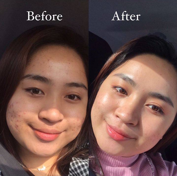 mieracart's tweet photo. Korang tengokla beza skin dulu dengan skin sekarang😍 https://t.co/wh7jhZ0lXL