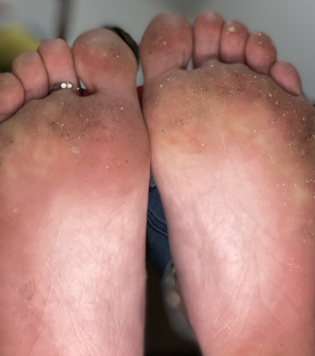 bunnybaref00t's tweet photo. I need a sub who would be more than willing to fund me for new boots & to get my nails done (your choice of color)😉👅
#subfund #paypig #humanatm #dirtyfeet #milffeet #feetfetish #solefetish #toefetish #tipme #sendcash #footslave #contentcreator #onlyfans #RT #dirtysoles https://t.co/S4X01C3s5b