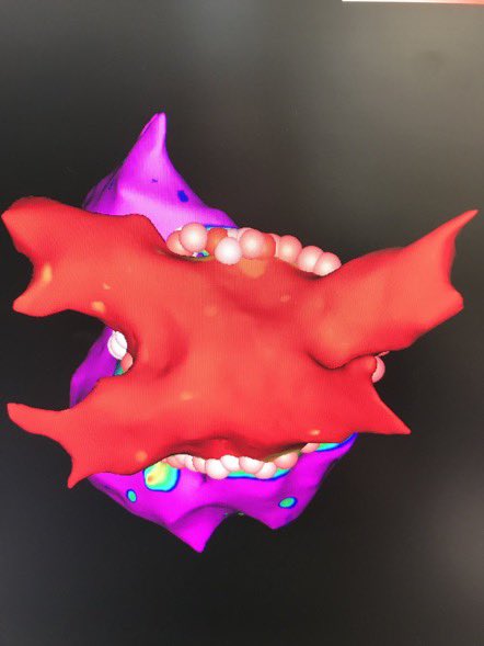 Anshul M. Patel, MD tweet media