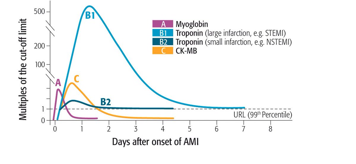 dr_pablomonroy's tweet image. #ENARM2023 #CardioTips Marcadores biológicos de necrosis miocárdica - SCACEST

1. Mioglobina: Primera proteína en aparecer en la circulación. Elevada sensibilidad y VPN. 

2. CK-MB: Alta concentración en el miocardio, alta sensibilidad pero no es cardioespecífica. 

(1/2)