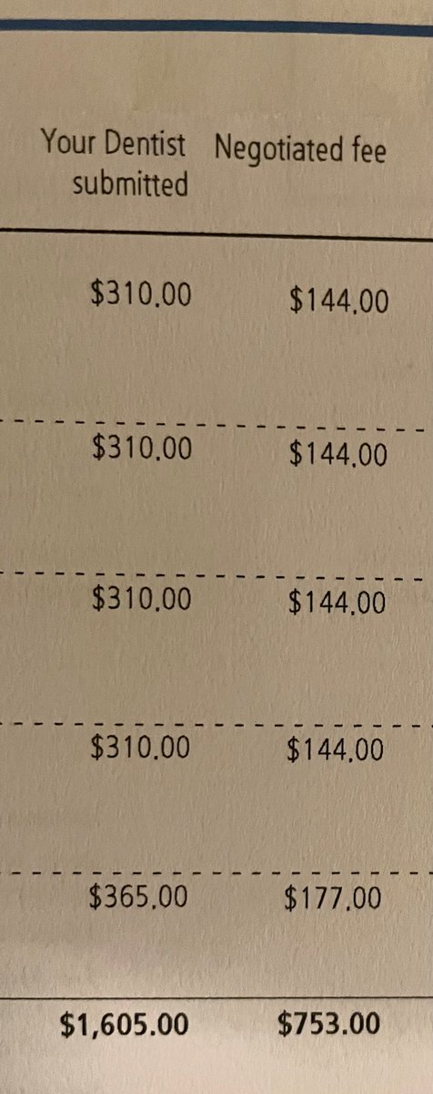 How is this a thing?