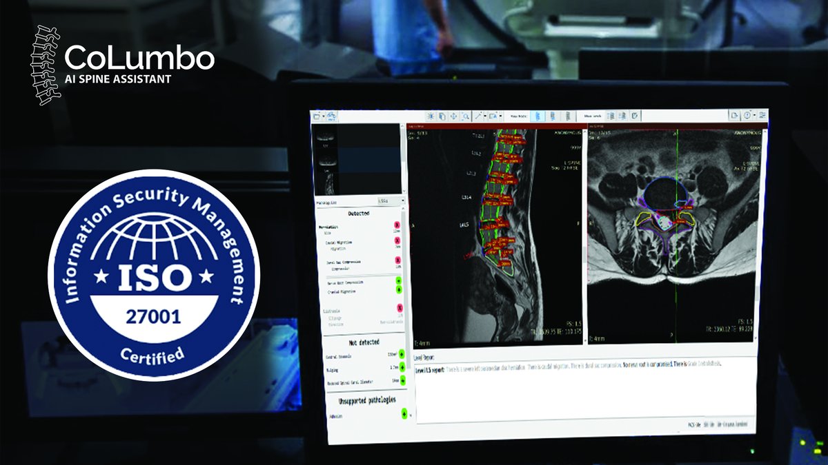 Smart Soft Healthcare is honoured to announce that CoLumbo AI spine assistant software received an ISO / IEC 27001 certification!
bit.ly/3sSlYc0