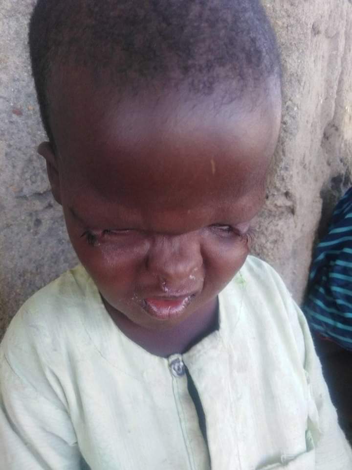 Mukefoundation's tweet image. During this harmattan is difficult for him to see, mustapha a 6 year old I am calling the Humanitarian aid workers to come and support him I have been doing it alone.