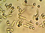 cecarnicom's tweet photo. Yeast Deformation: Initial Report
https://t.co/uLmVdXV3gv https://t.co/UMzf9uefKW