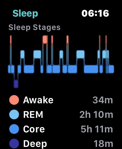 SnoreApp's tweet photo. #Kundenfeedback: „Danke für Eure App, ich komme mit ihr viel besser durch die Nacht und bin viel erholter“ https://t.co/qcvvUDgXWr