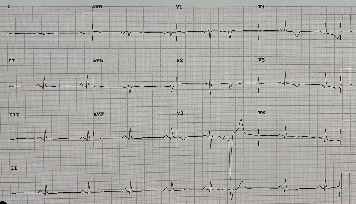 Julian P Villacastin tweet media