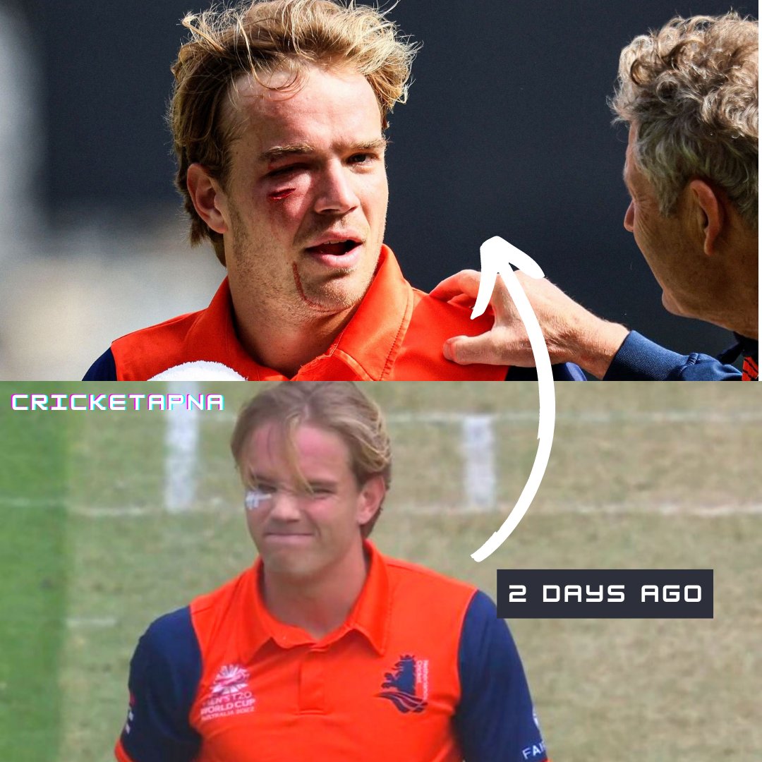 Hats off to Bas de Leede for his commitment and dedication towards the game.
.
.
.
#BasdeLeede #ZIMVSNED #NEDVSZIM #HatsOff