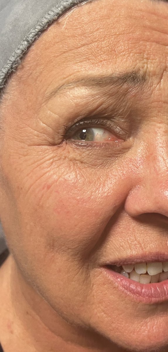heavenskincare's tweet photo. This is lipolis 7 it’s a fantastic anti-aging treatment that takes less then half an hour ! @Salon_Heaven https://t.co/2G8XKFvAzP