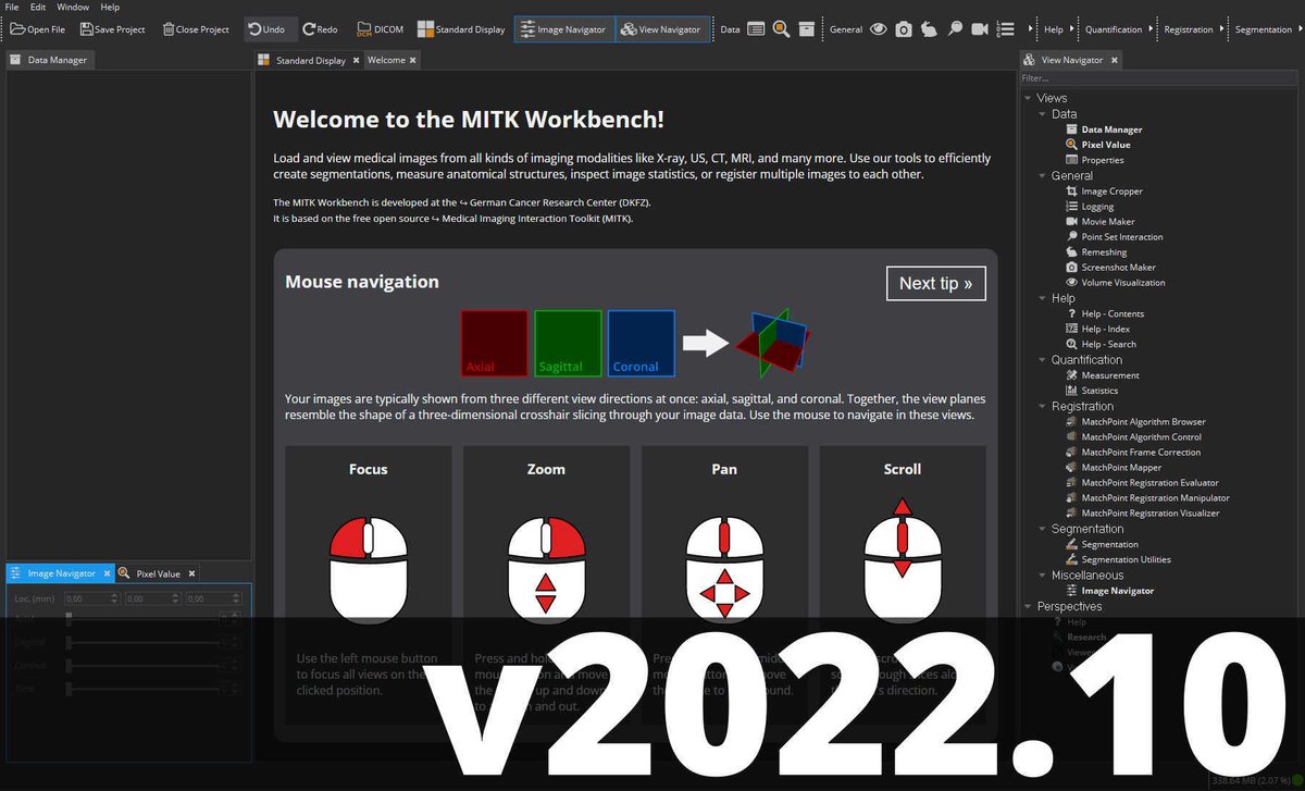 The MITK team of MIC proudly presents the latest release of the MITK Workbench: v2022.10. 🎉
Downloads for Windows 10+, Ubuntu 20.04+ and macOS Catalina+ are available on our webpage: mitk.org/wiki/Downloads.