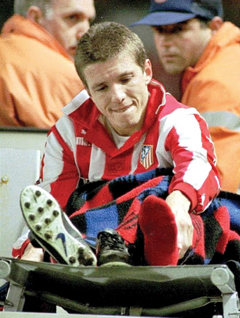 DiegoGArgota21's tweet photo. "Doctor ¿Y el Mundial?" Según el médico que le operó, eso fue lo único que salió de su boca.

Era febrero de 1998. Juninho Paulista corría enfilado a hacer su 8º gol de la temporada cuando una terrorífica entrada le destrozó el alma, el corazón, y el peroné. Se quedó sin Mundial. https://t.co/CuVAUTPC3M