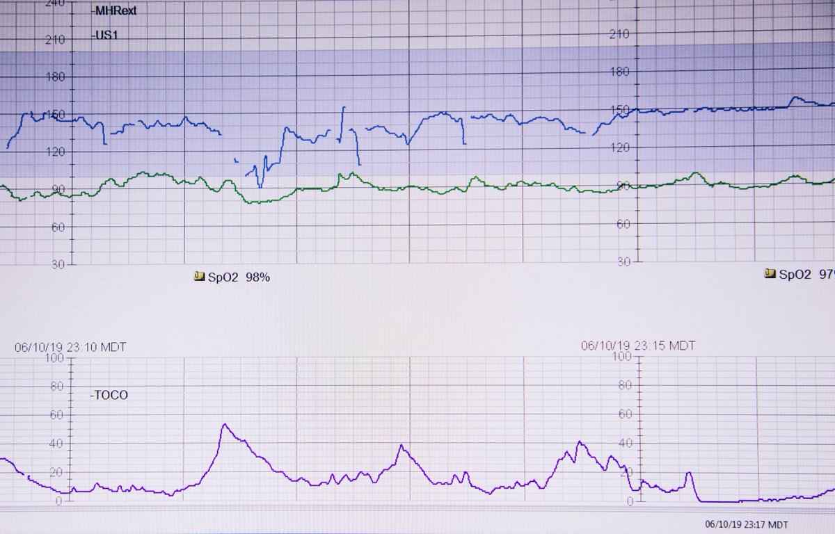 It's tricky to get information about what people are actually doing with #CTG monitoring. What does your practice look like? buff.ly/3SDaxiT